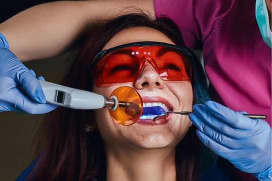 Laser Teeth Cleaning